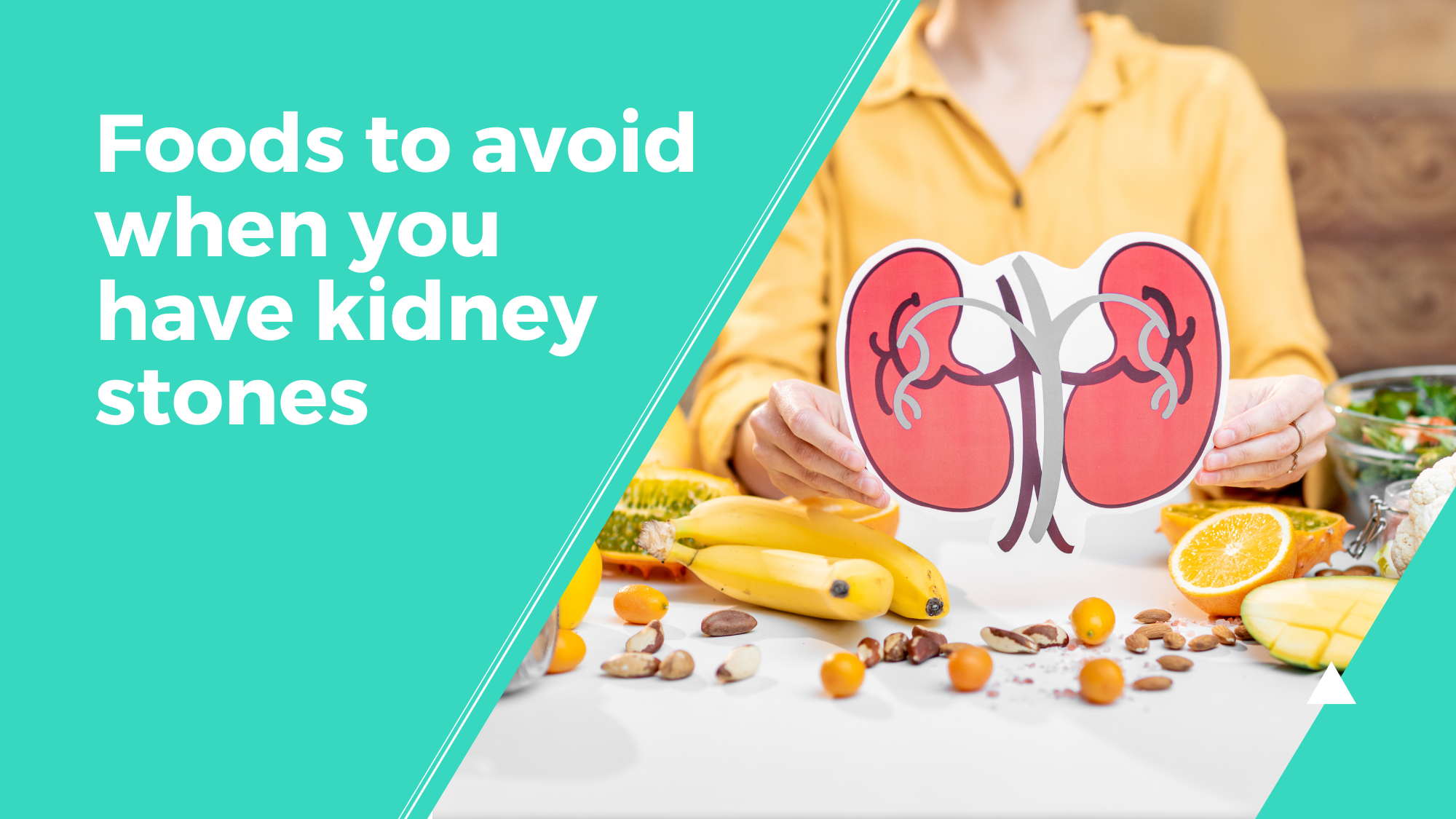 foods-to-avoid-when-you-have-kidney-stones